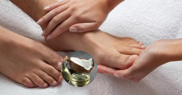 सर्दियों में फटी एड़ियों और रूखे हाथों की देखभाल के असरदार तरीके